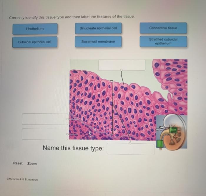 Correctly identify this tissue type and label