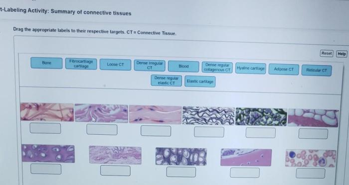 Art-labeling activity summary of connective tissues