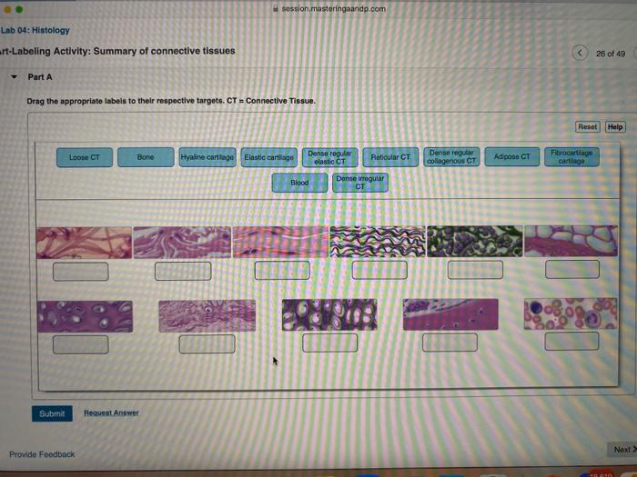 Epithelial summary labeling activity tissues appropriate respective drag labels chegg targets their solved answers stratified simple