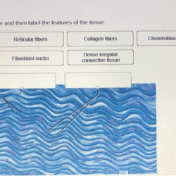 Tissue identify correctly type label then features epithelial cells dead has solved epithelium stratified squamous transcribed problem text been show