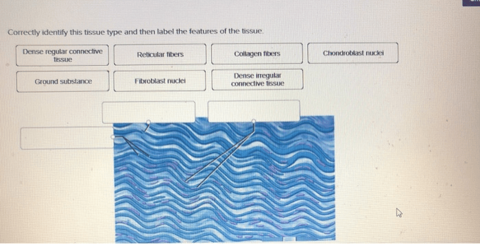 Tissue identify correctly type label then features epithelial cells dead has solved epithelium stratified squamous transcribed problem text been show