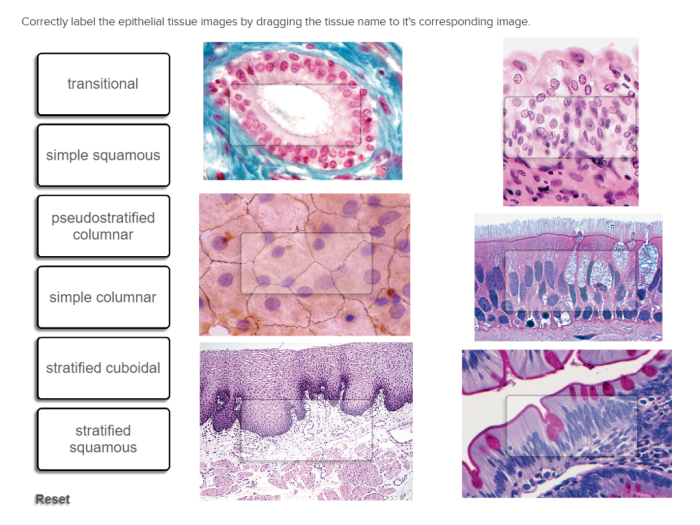 Correctly identify this tissue type and label